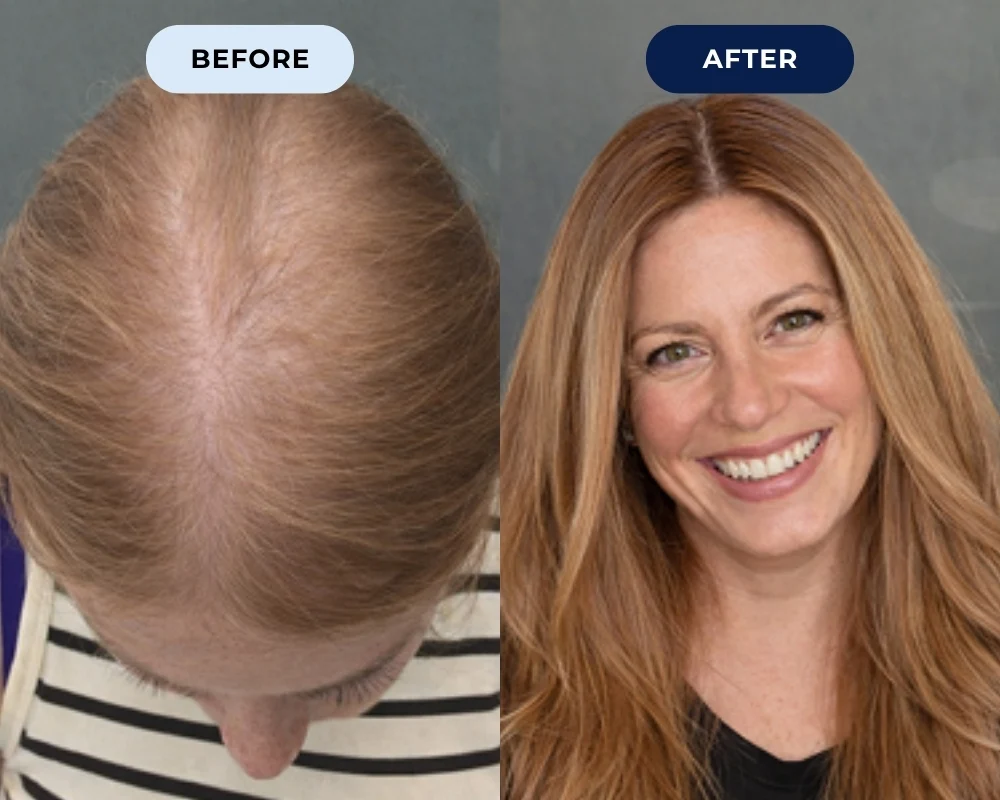 Amanda R. before and after results