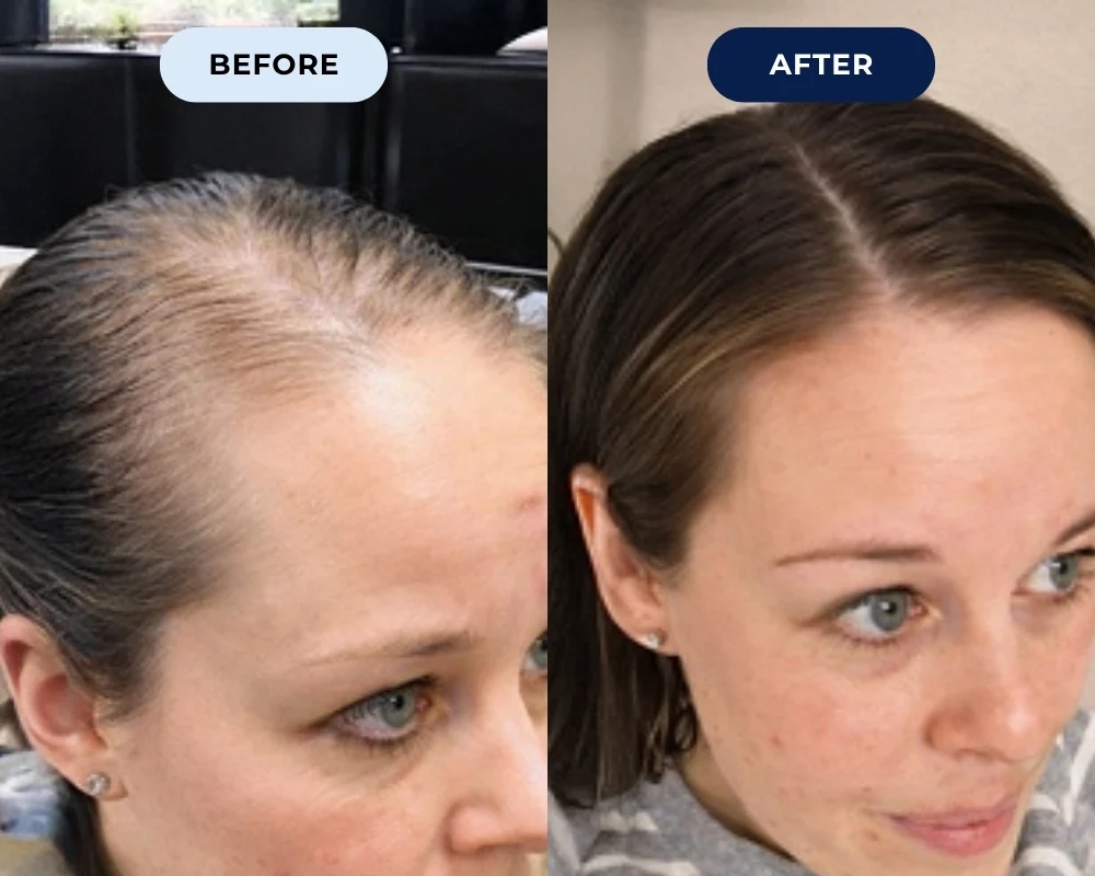 Kate P. before and after results