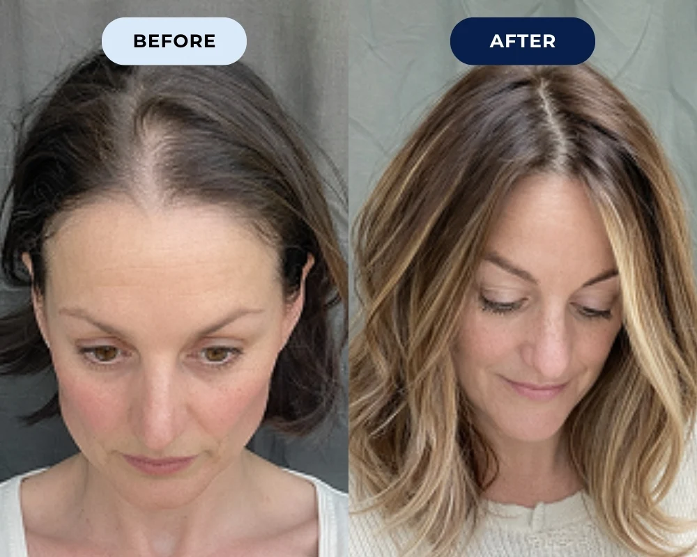 Joanne Ch. before and after results
